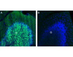 Anti-GABA(A) β3 Receptor Antibody