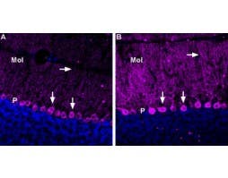 Anti-GABA(A) ε Receptor (GABRE) (extracellular) Antibody