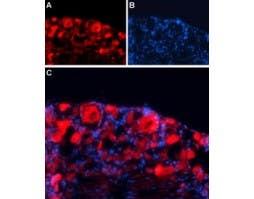 Anti-GABA(A) γ1 Receptor Antibody