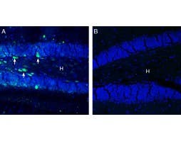 Anti-GABA(A) π Receptor (extracellular) Antibody