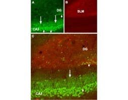 Anti-GABA(B) R1 (extracellular) Antibody