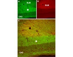 Anti-GABA(B) R2 Antibody