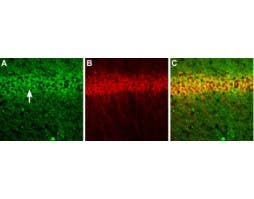 Anti-NMDAR1 (GluN1) (extracellular) Antibody