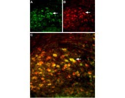 Anti-NMDAR2A (GluN2A) (extracellular) Antibody