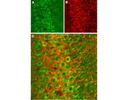 Anti-NMDAR2B (GluN2B) (extracellular) Antibody