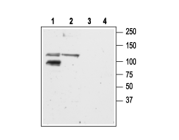 Anti-GRIK2 (GluK2) Antibody
