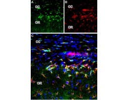 Anti-mGluR2 (extracellular) Antibody