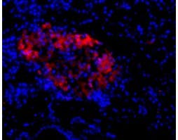 Anti-NMDAR2C (GRIN2C) (extracellular) Antibody