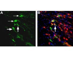 Anti-NMDAR2D (GRIN2D) (extracellular) Antibody