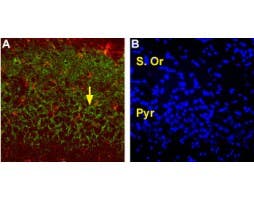 Anti-EAAT2 (GLT-1) (extracellular) Antibody