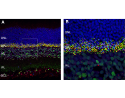 Anti-mGluR6 (extracellular) Antibody