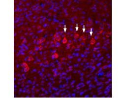 Anti-NMDAR3B (GRIN3B) (extracellular) Antibody