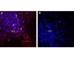 Guinea Pig Anti-VGLUT1 Antibody