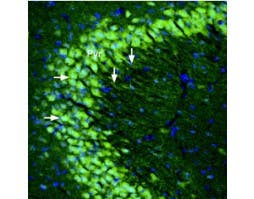 Anti-GRIK5 (GluK5) (extracellular) Antibody