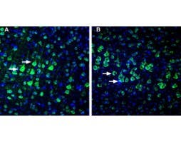 Anti-NETO1 (extracellular) Antibody