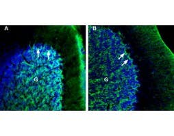 Anti-NETO2 (extracellular) Antibody