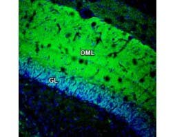 Anti-GSG1L Antibody