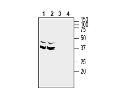 Anti-SynDIG1 Antibody