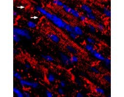 Guinea pig Anti-Na<sub>V</sub>1.5 (SCN5A) Antibody