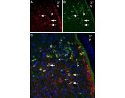 Guinea pig Anti-SCN2A (Na<sub>V</sub>1.2) Antibody