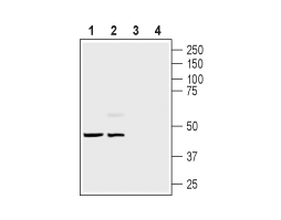 Guinea pig Anti-Endothelin Receptor B Antibody