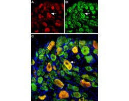 Anti-ASIC3 Antibody