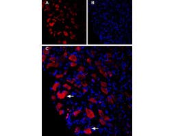 Guinea pig Anti-Ca<sub>V</sub>1.3 (CACNA1D) Antibody