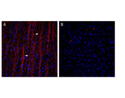 Guinea pig Anti-P2Y12 Receptor (extracellular) Antibody