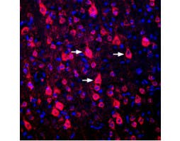 Guinea pig Anti-D<sub>1</sub> Dopamine Receptor Antibody