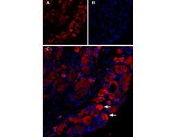 Guinea pig Anti-TRPV1 (VR1) Antibody