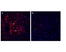 Guinea Pig Anti-VGLUT2 Antibody