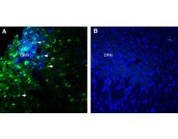 Anti-Glycine Receptor α3 Antibody