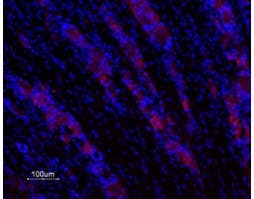 Anti-GALR1 Antibody