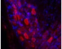 Anti-GALR2 Antibody