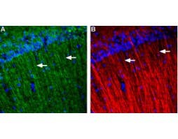 Anti-GALR3 (extracellular) Antibody