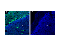 Anti-Glycine Receptor β Antibody