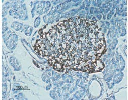 Anti-GLP1R (extracellular) Antibody