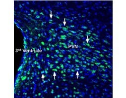 Anti-Glucagon Receptor (extracellular) Antibody