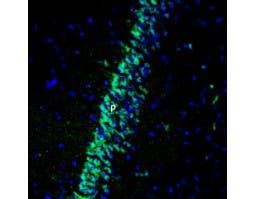 Anti-GIPR (extracellular) Antibody