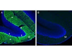 Anti-Secretin Receptor (extracellular) Antibody