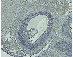 Anti-GnRH Receptor (extracellular) Antibody