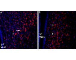 Anti-Ghrelin Receptor (GHSR) (extracellular) Antibody