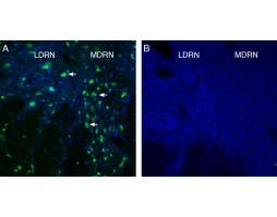 Anti-GPR4 (extracellular) Antibody