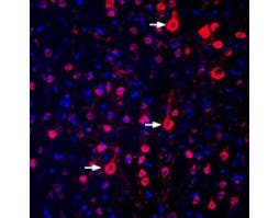 Anti-GPR17 Antibody