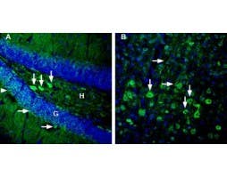 Anti-GPR83 (extracellular) Antibody