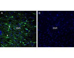 Anti-GPR52 Antibody