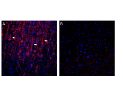 Anti-GPR183 (extracellular) Antibody