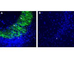 Anti-GPR31 (extracellular) Antibody