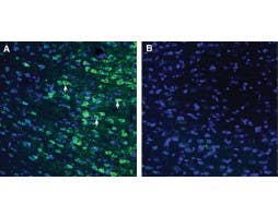 Anti-GPR18 (extracellular) Antibody