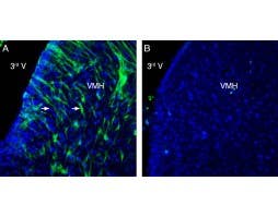 Anti-GPR139 Antibody